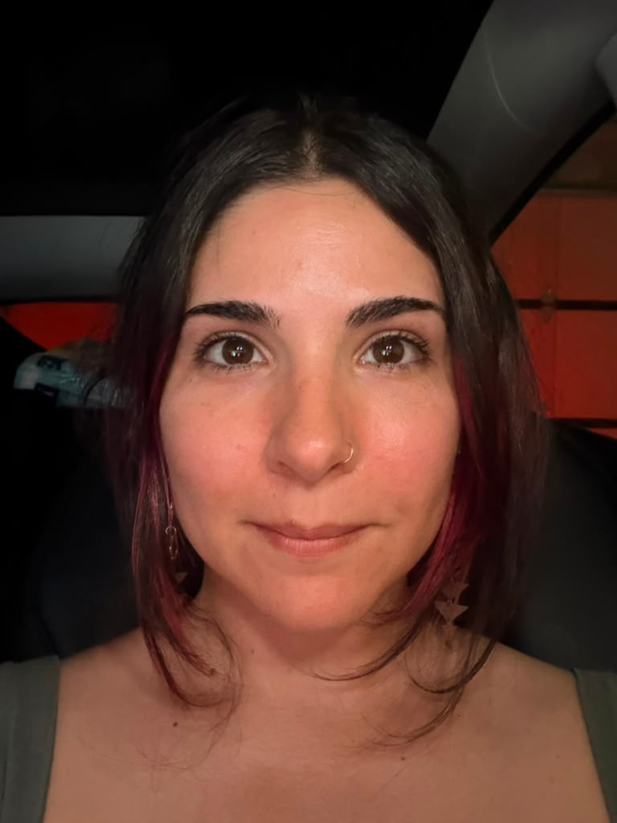 Dr. La Rocca 1 day after PRP Microneedling